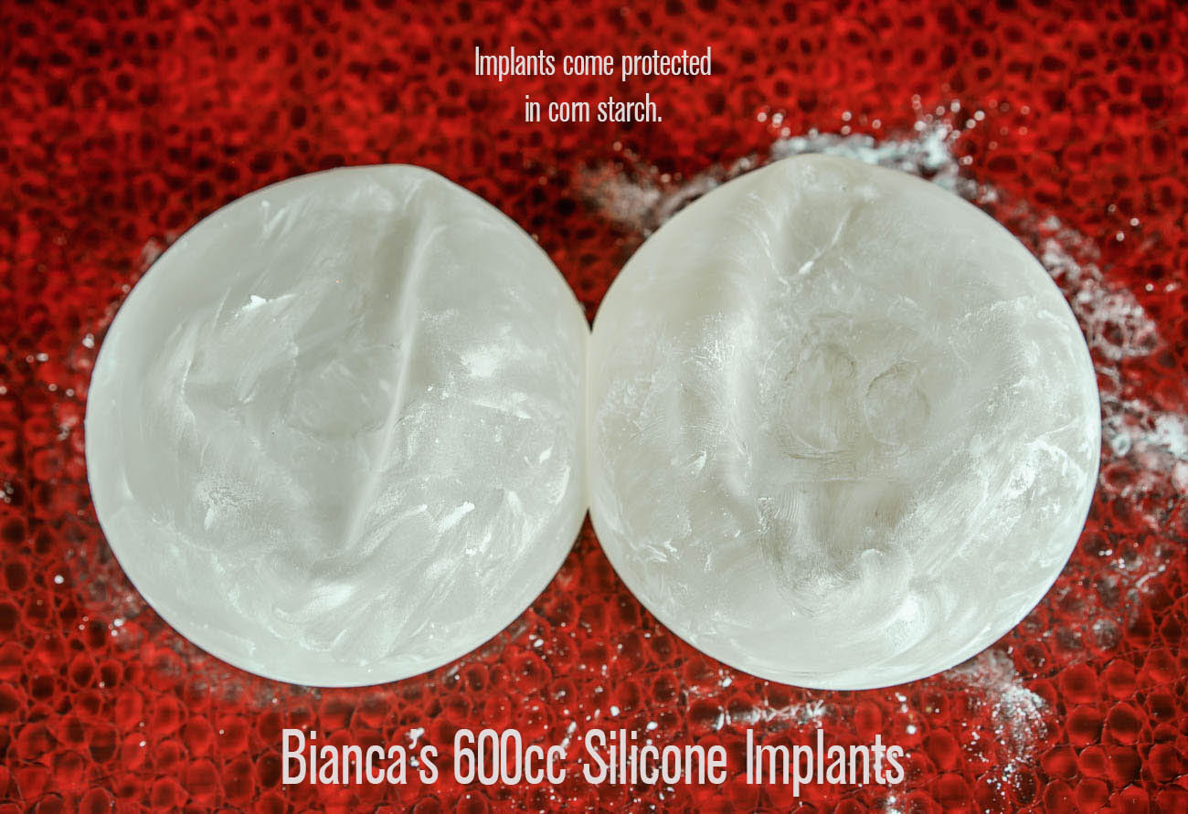 bianca-beauchamp-implants-600cc-10.