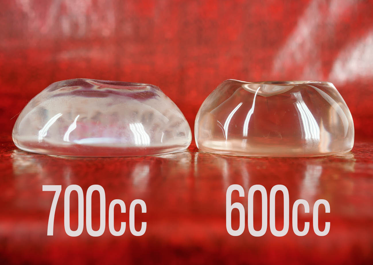 600cc VS 700cc IMPLANTS, BATTLE OF THE SIZES.