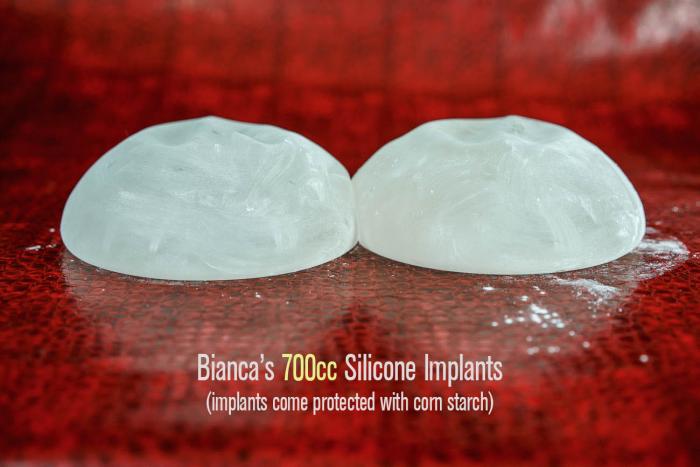 bianca-beauchamp-implants-700cc-09.
